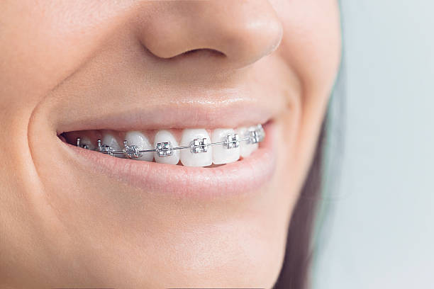 Best Invisalign and Clear Aligners  in Fairview, NY